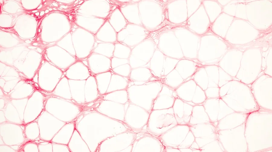 plant stem cross section disease